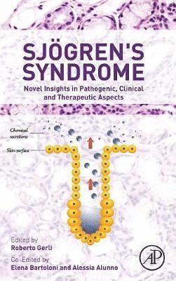 bokomslag Sjogren's Syndrome