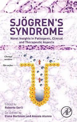 bokomslag Sjogren's Syndrome