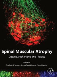 bokomslag Spinal Muscular Atrophy