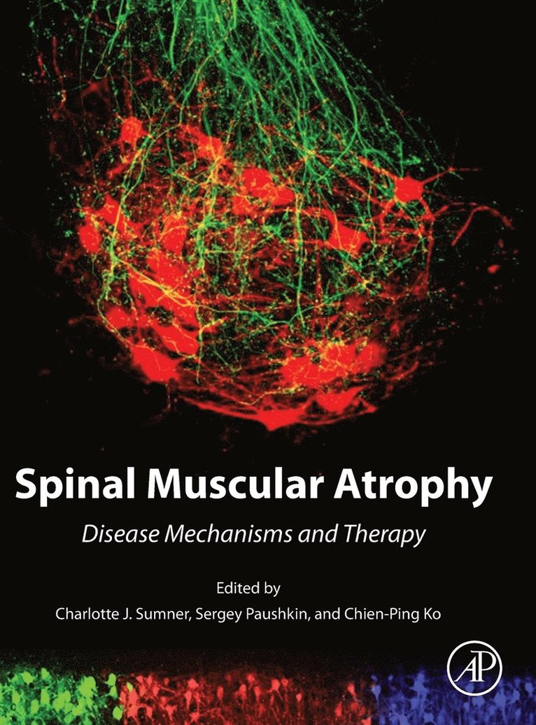 Spinal Muscular Atrophy 1