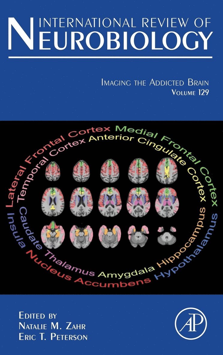 Imaging the Addicted Brain 1