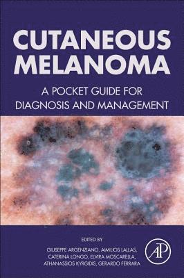 bokomslag Cutaneous Melanoma