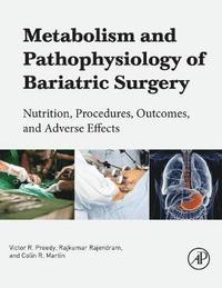 bokomslag Metabolism and pathophysiology of bariatric surgery - nutrition, procedures