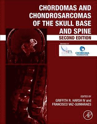 Chordomas and Chondrosarcomas of the Skull Base and Spine 1