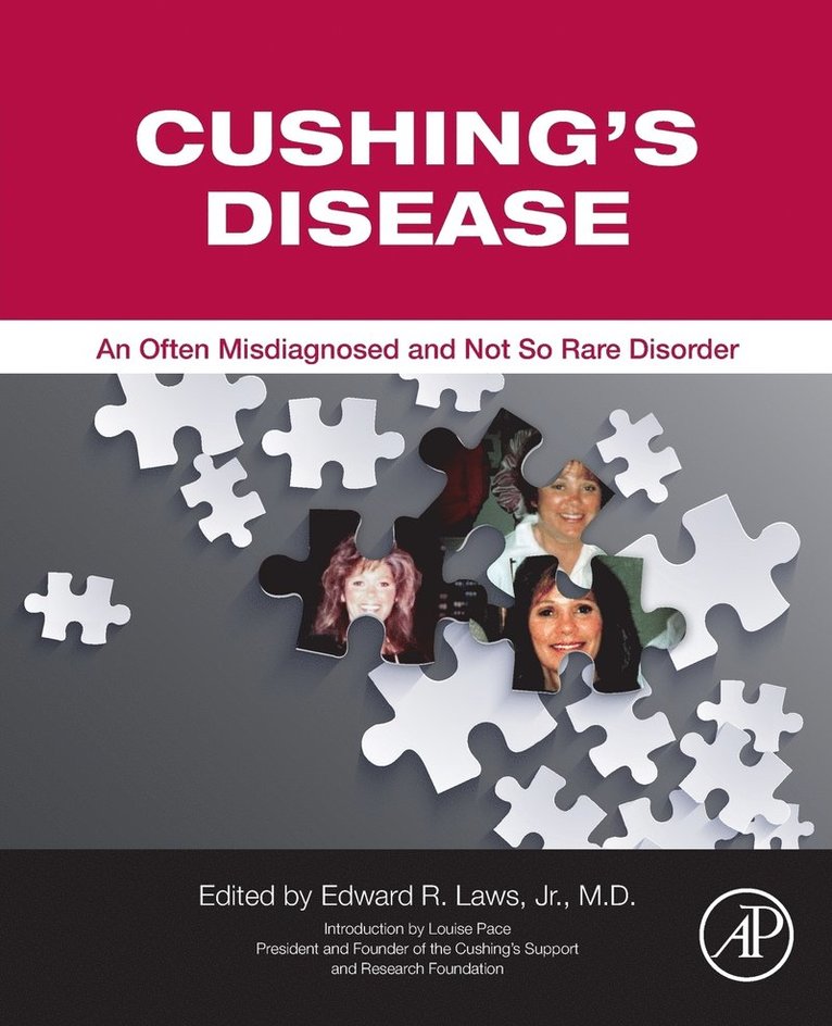 Cushing's Disease 1