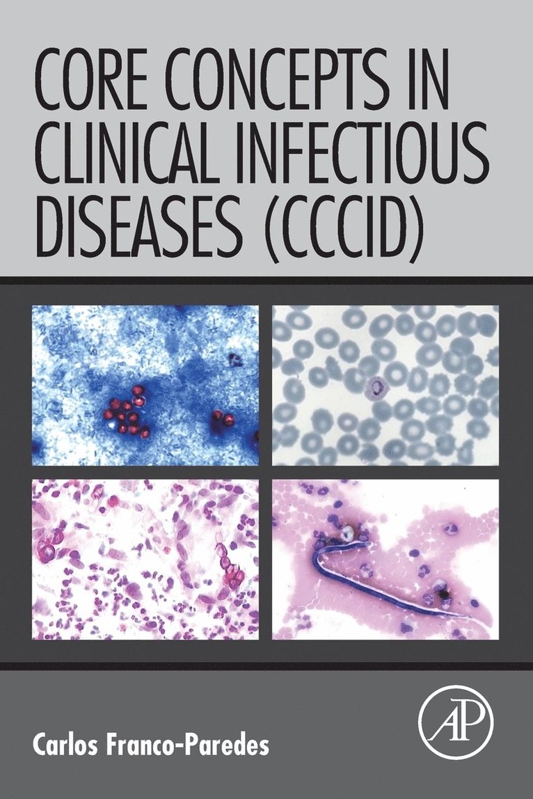 Carlos Franco-Paredes, Mexico) Franco-Paredes, Carlos (Infectious Diseases Clinician, Adjunct Clinical Professor, Hospital Infantil de Mexico, Federico Gomez, Mexico City - Core Concepts in Clinical Infectious Diseases (CCCID), Häftad