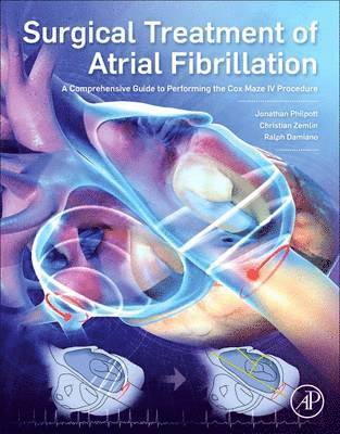 bokomslag Surgical Treatment of Atrial Fibrillation