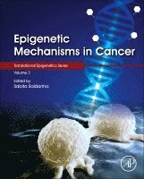 Epigenetic Mechanisms in Cancer 1