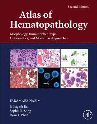 Atlas of Hematopathology 1