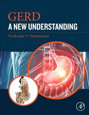 GERD 1