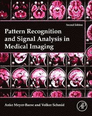 Pattern Recognition and Signal Analysis in Medical Imaging 1