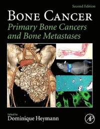 bokomslag Bone Cancer: Primary Bone Cancers and Bone Metastases