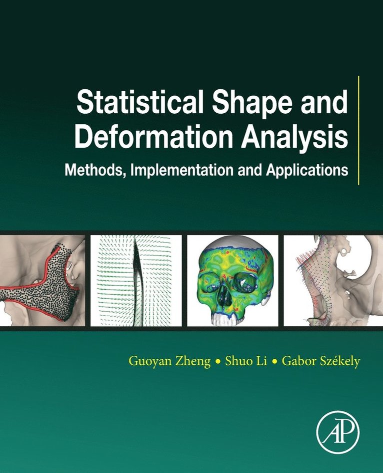 Statistical Shape and Deformation Analysis 1