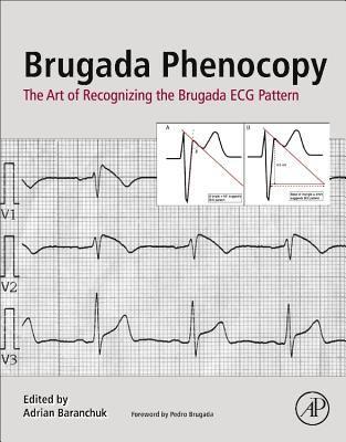 bokomslag Brugada Phenocopy