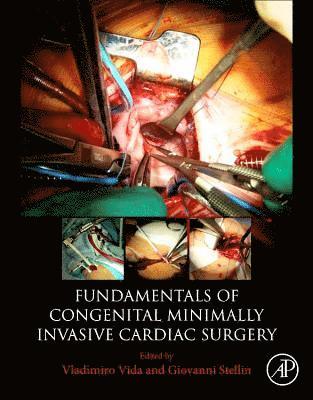 Vladimiro Vida, Giovanni Stellin, Italy) Vida, Vladimiro (Pediatric Cardiac Surgery Unit, University of Padua Medical School - Fundamentals of Congenital Minimally Invasive Cardiac Surgery, Häftad