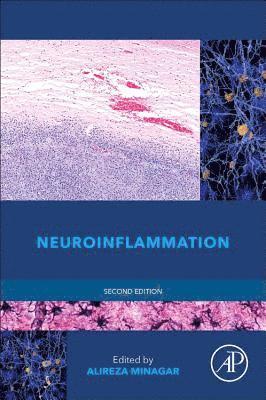 Neuroinflammation 1