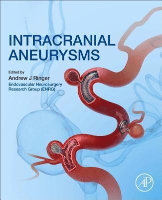 bokomslag Intracranial Aneurysms