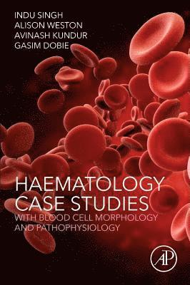 Indu Singh, Alison Weston, Avinash Kundur, Gasim Dobie - Haematology Case Studies with Blood Cell Morphology and Pathophysiology, Häftad