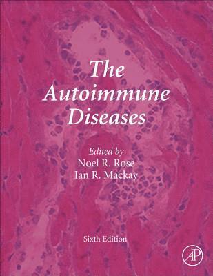 The Autoimmune Diseases 1