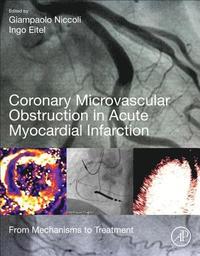 bokomslag Coronary Microvascular Obstruction in Acute Myocardial Infarction