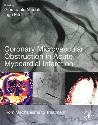 Coronary Microvascular Obstruction in Acute Myocardial Infarction 1