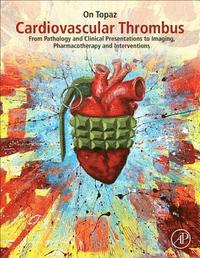 bokomslag Cardiovascular Thrombus