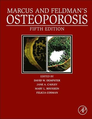 Marcus and Feldman's Osteoporosis 1