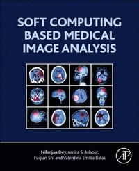 bokomslag Soft Computing Based Medical Image Analysis