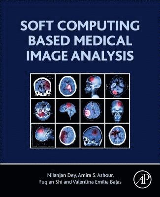 bokomslag Soft Computing Based Medical Image Analysis