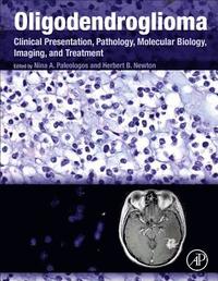 bokomslag Oligodendroglioma