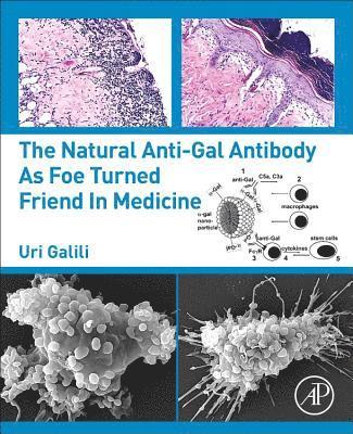 bokomslag The Natural Anti-Gal Antibody as Foe Turned Friend in Medicine