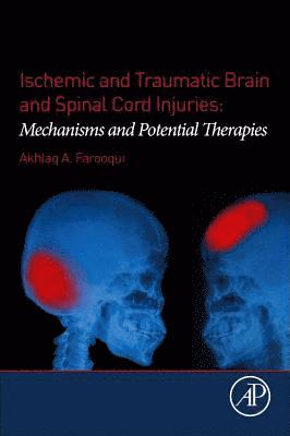 bokomslag Ischemic and Traumatic Brain and Spinal Cord Injuries