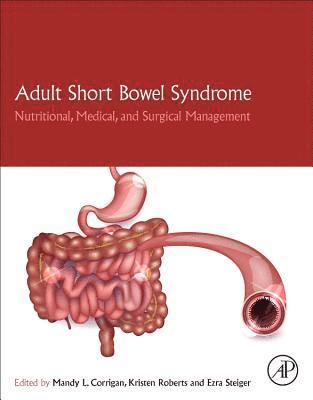 bokomslag Adult Short Bowel Syndrome