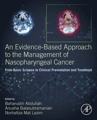 bokomslag An Evidence-Based Approach to the Management of Nasopharyngeal Cancer