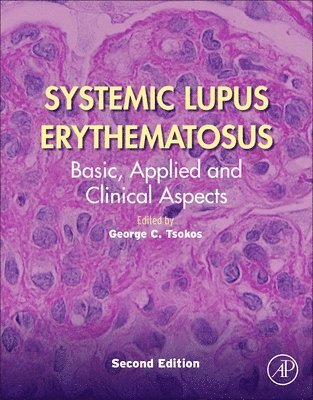 bokomslag Systemic Lupus Erythematosus