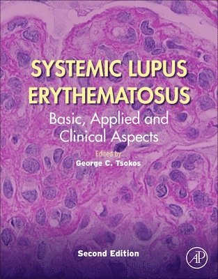 bokomslag Systemic Lupus Erythematosus