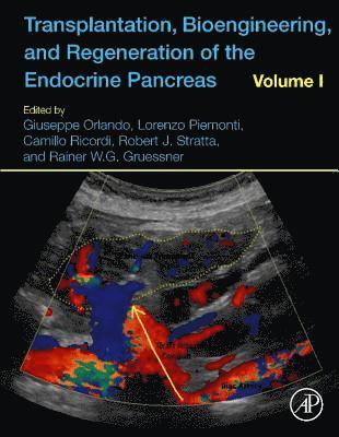 Transplantation, Bioengineering, and Regeneration of the Endocrine Pancreas 1