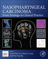 Anne W.M. Lee, Maria Li Lung, Wai Tong Ng - Nasopharyngeal Carcinoma, Häftad
