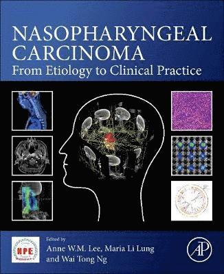 bokomslag Nasopharyngeal Carcinoma