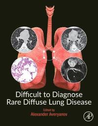 bokomslag Difficult to Diagnose Rare Diffuse Lung Disease