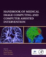 S. Kevin Zhou, Daniel Rueckert, Gabor Fichtinger - Handbook of Medical Image Computing and Computer Assisted Intervention, Inbunden