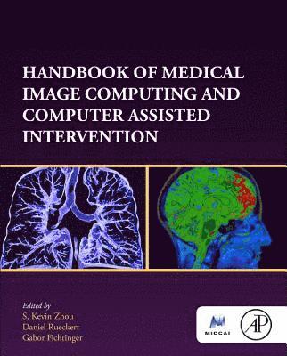 Handbook of Medical Image Computing and Computer Assisted Intervention 1