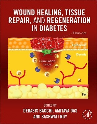 Wound Healing, Tissue Repair, and Regeneration in Diabetes 1