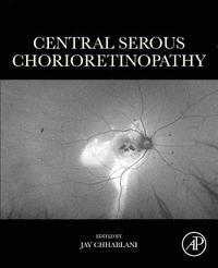 bokomslag Central Serous Chorioretinopathy