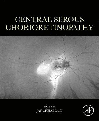 bokomslag Central Serous Chorioretinopathy