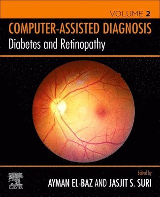 bokomslag Diabetes and Retinopathy