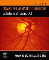 Ayman S. El-Baz, Jasjit S. Suri - Diabetes and Fundus OCT, Häftad