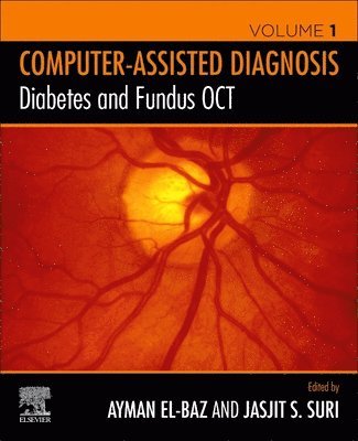 bokomslag Diabetes and Fundus OCT