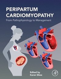 bokomslag Peripartum Cardiomyopathy