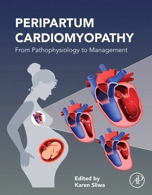 Peripartum Cardiomyopathy 1